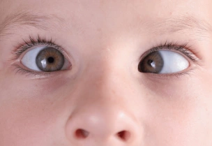 pediatric ophthalmologist in Mumbai
